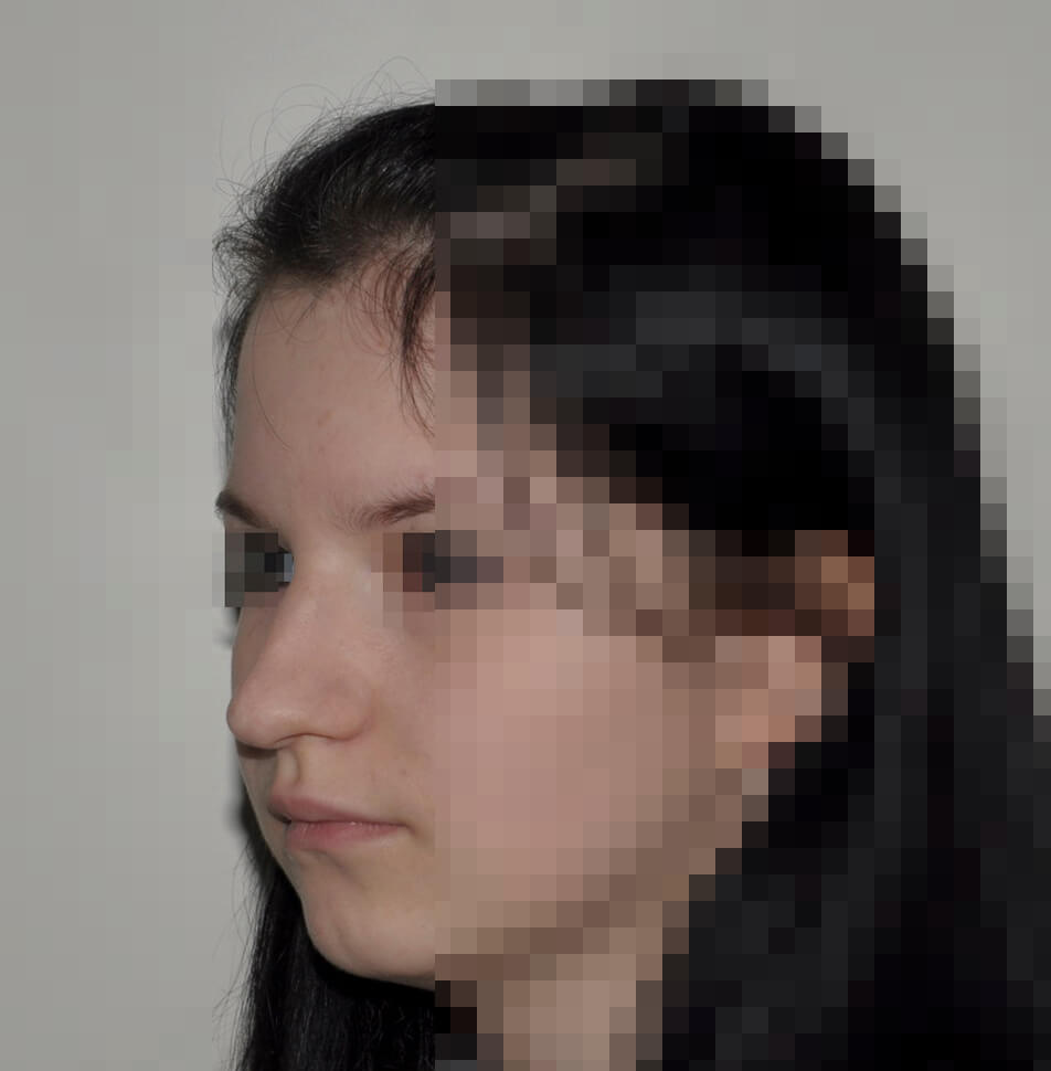 До операции