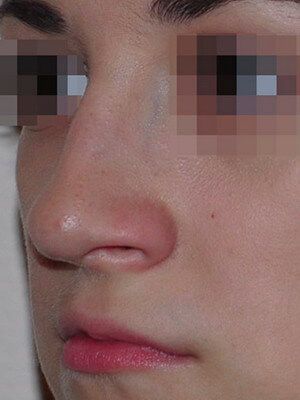 Пациент 6